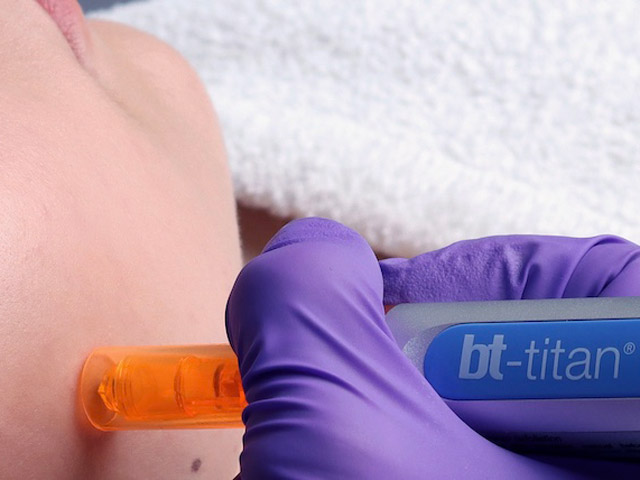 Dermapen